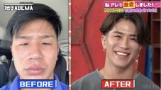 香取慎吾ら「整形費用300万円」で岩田剛典似に“激変”の施術内容に興味津々！【ななにー 地下ABEMA】 - 画像一覧（2/3）